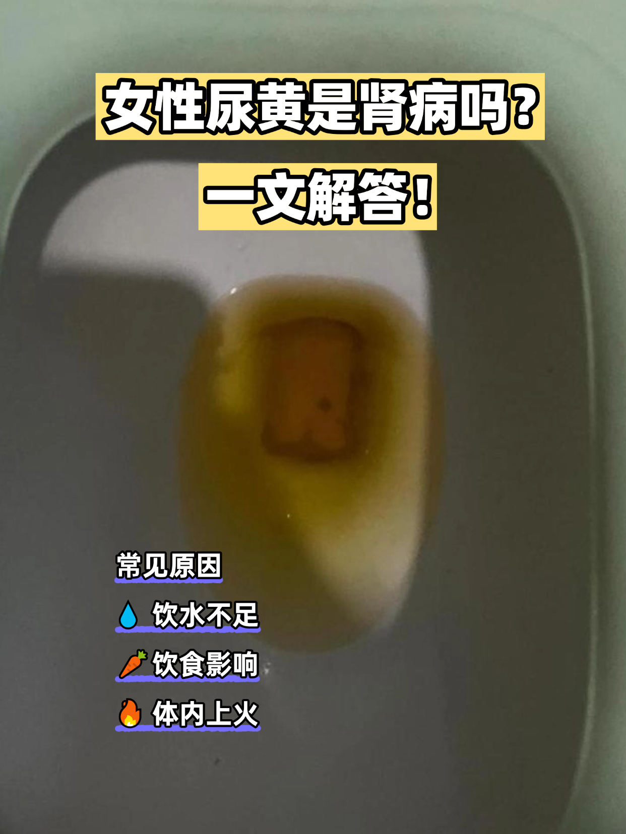 尿液发黄是什么情况?