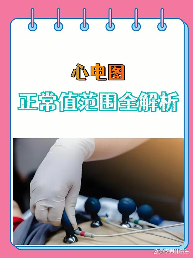 窦性心律pr间期正常范围