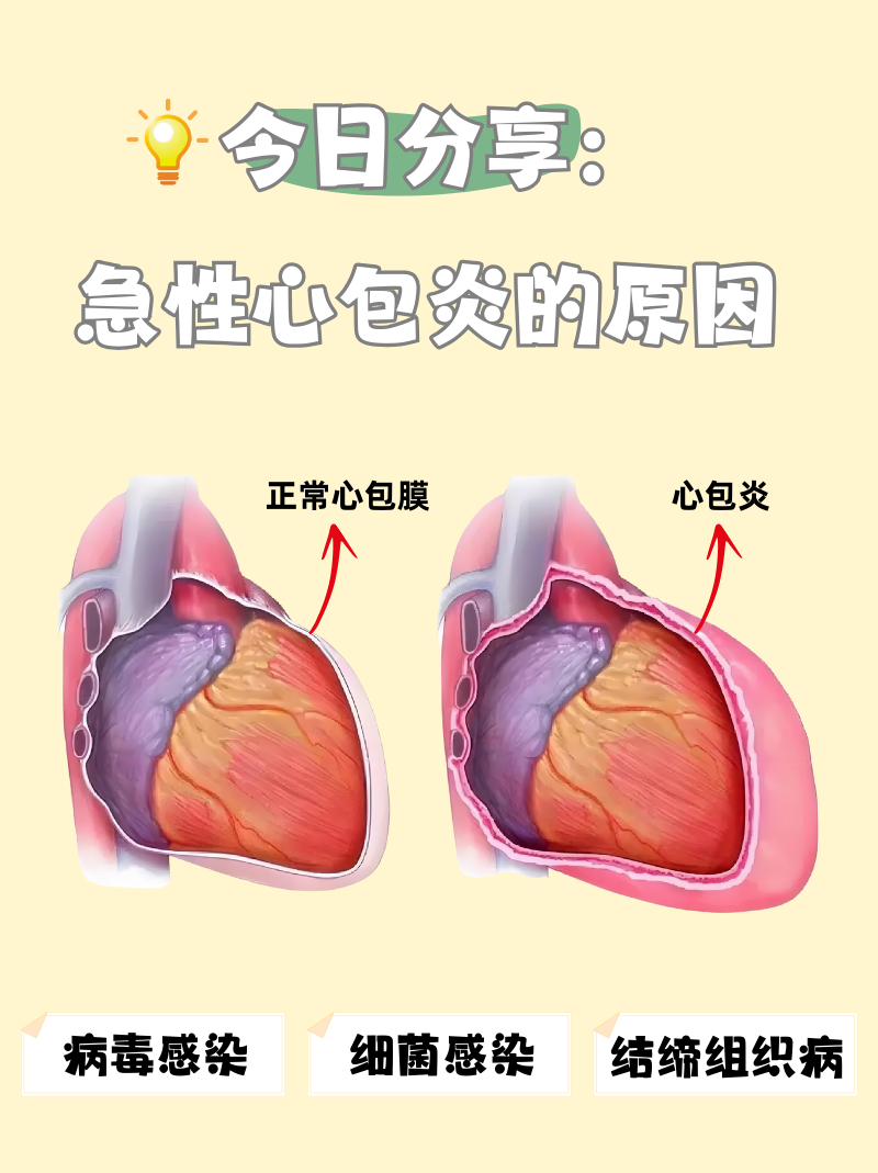 什么是心血管疾病?