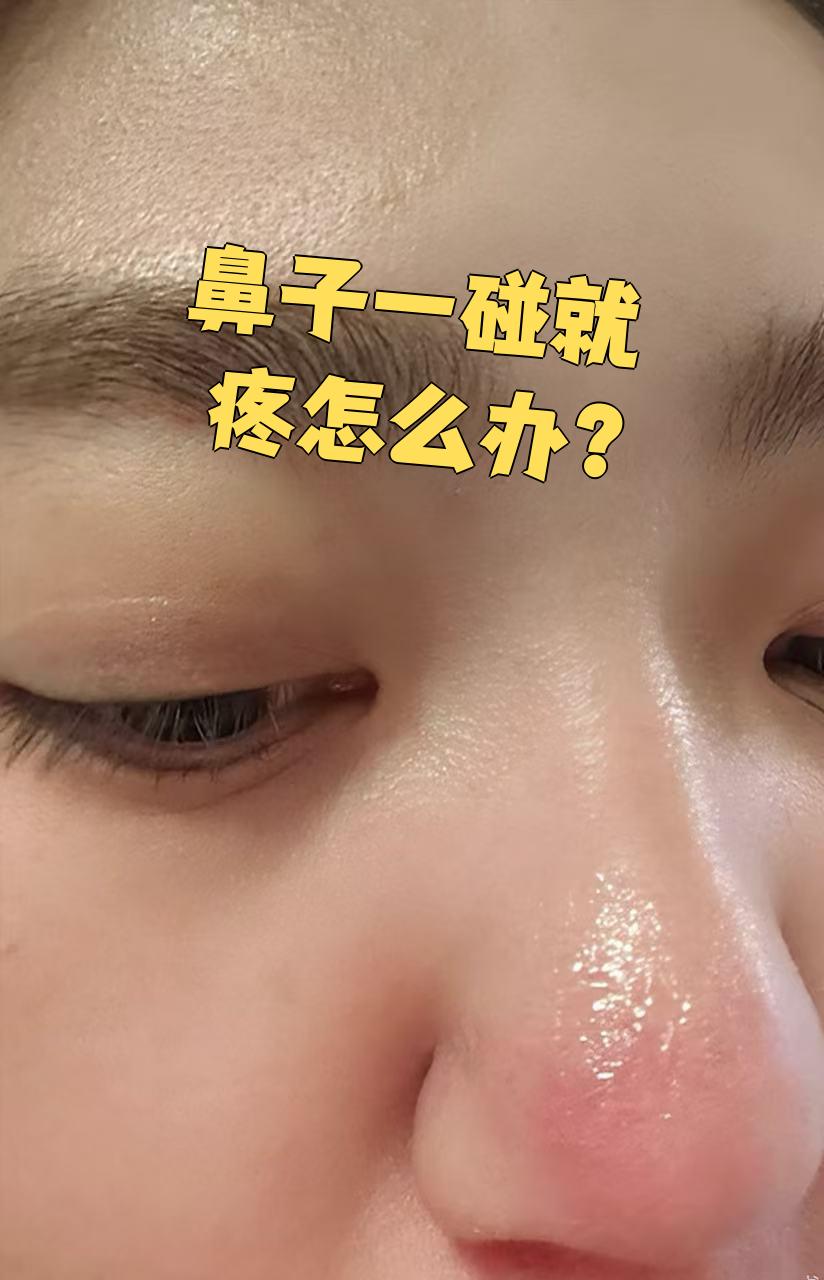 鼻子两侧发红,怎么回事.