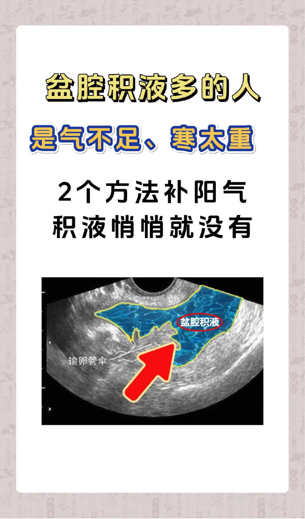 慢性盆腔积液怎么治?