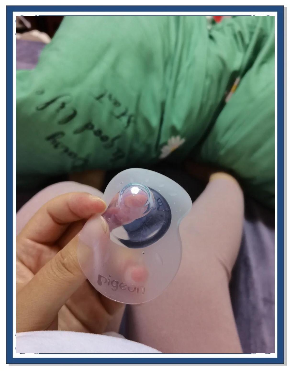 乳头短婴儿吸不出奶怎么办