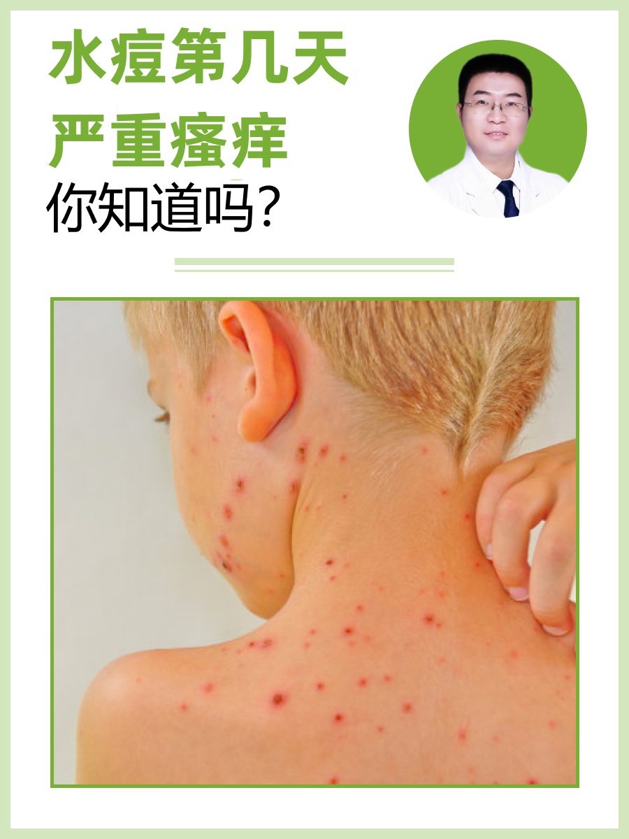 脓疱疮什么症状?和水痘有什么区别?