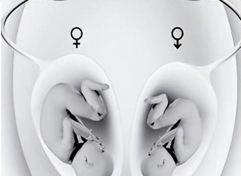 双子宫能生孩子吗