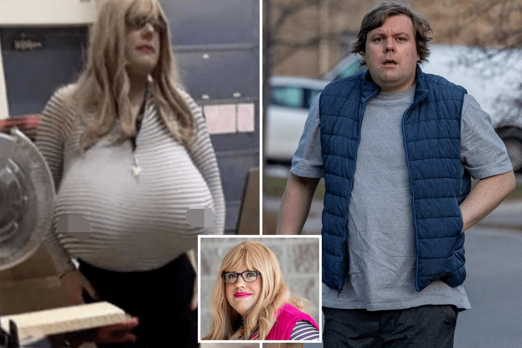 巨乳症是什么症状?