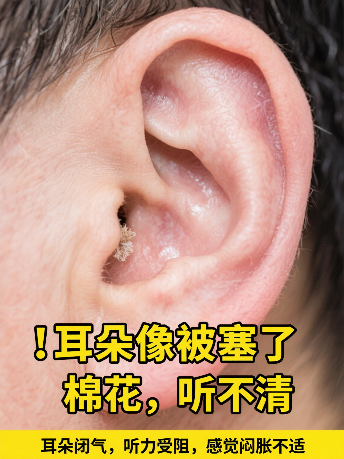 耳朵突然像堵住了一样是怎么回事