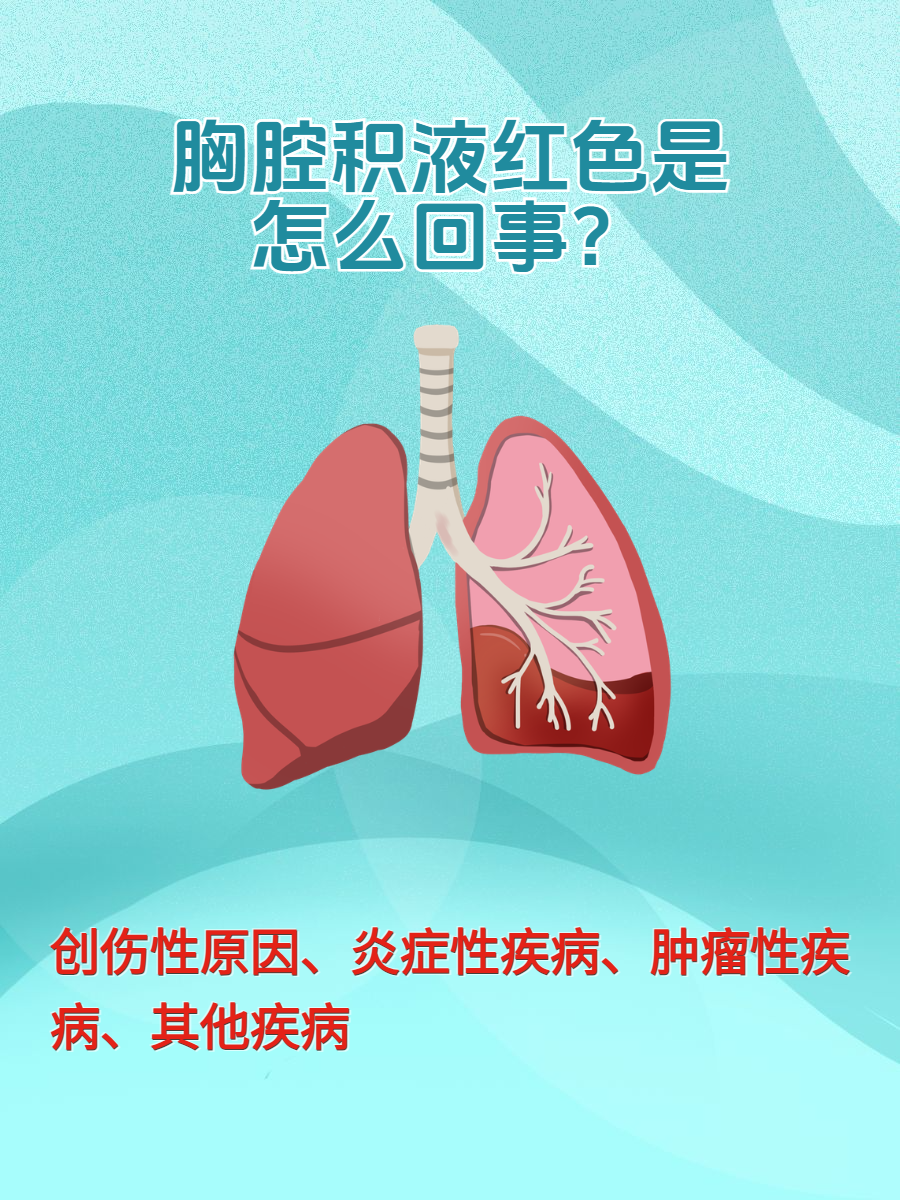 胸腔积液严重吗
