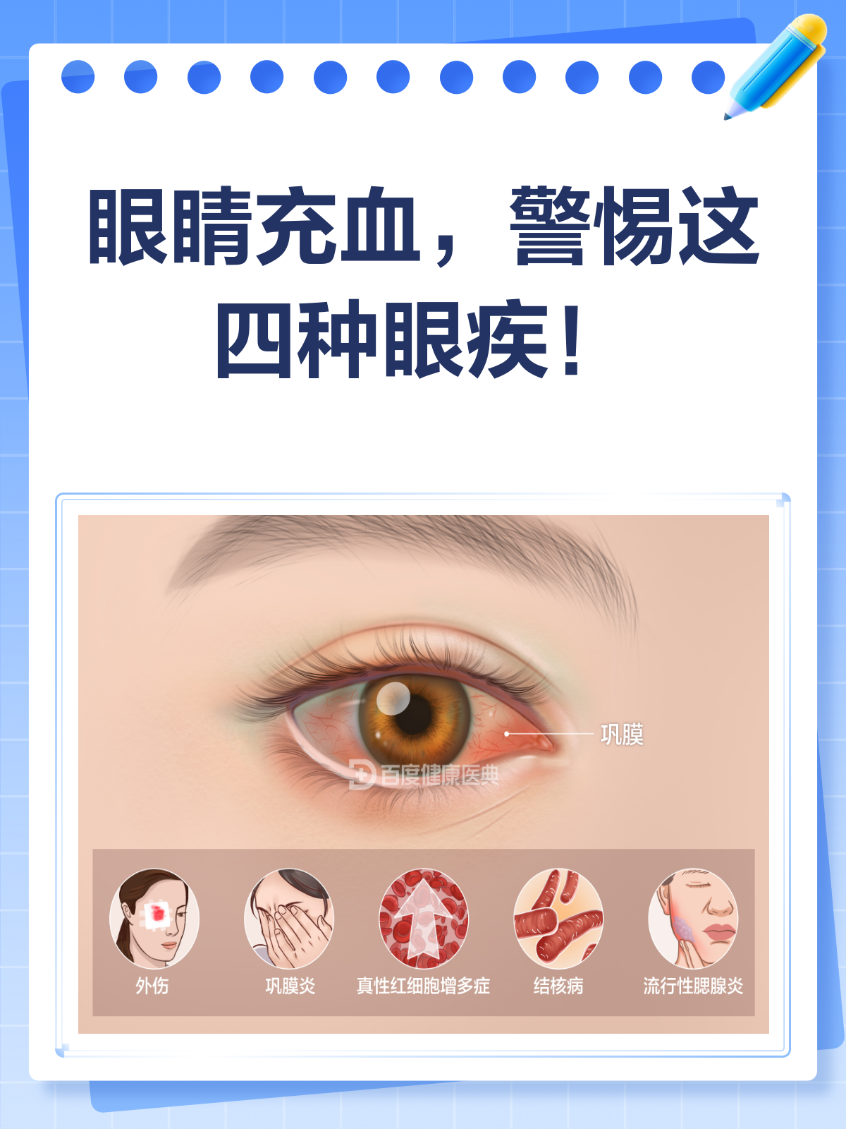 为什么会得红眼病???