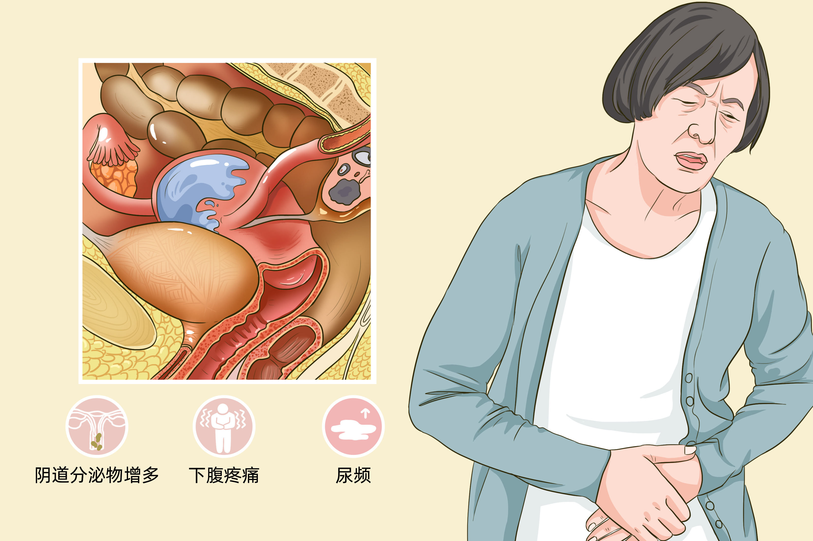 盆腔积液的症状有哪些