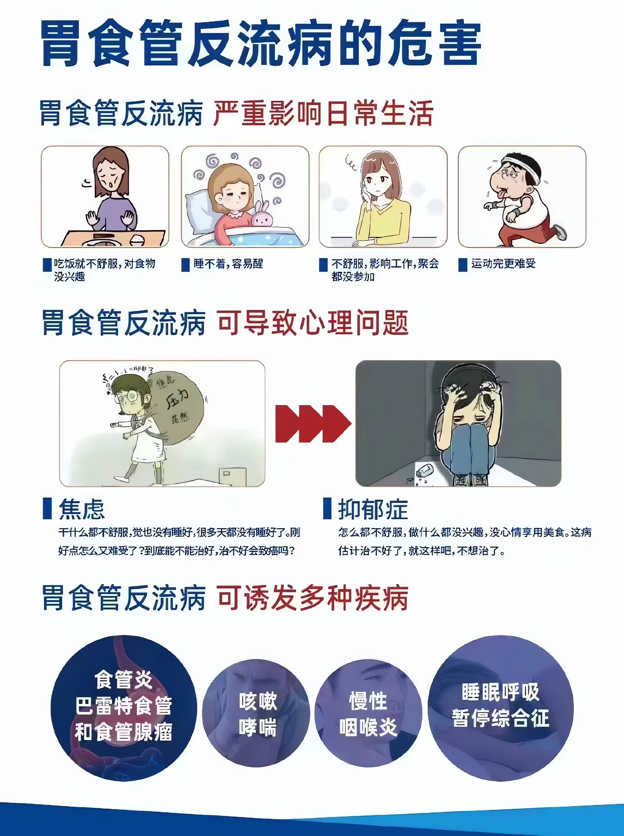 胃食管反流病的临床症状表现