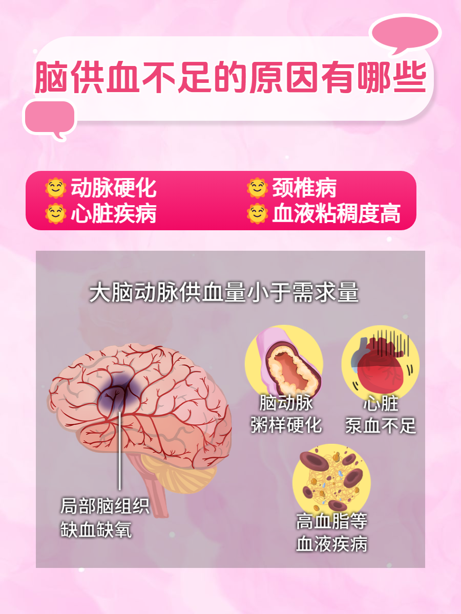脑供血不足的治疗