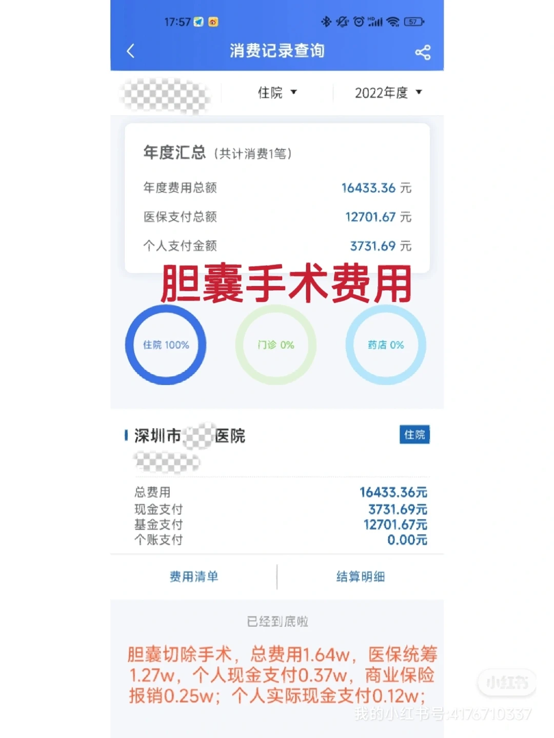 胆囊炎手术费大概要多少