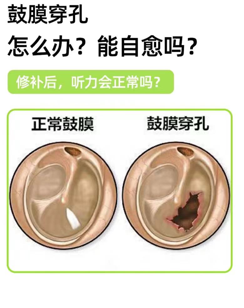 掏耳朵会不会碰到鼓膜?