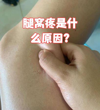 膝盖后面的腿窝筋痛怎么办