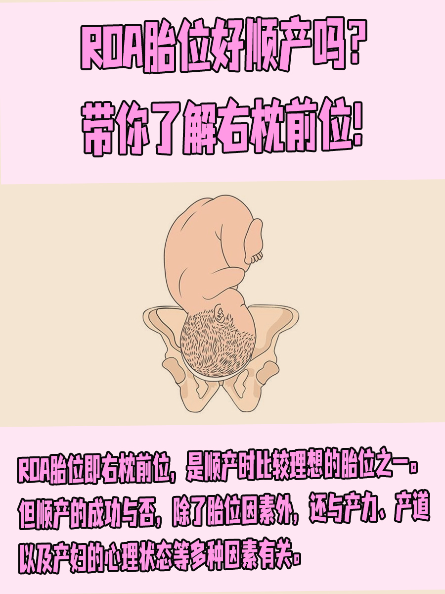 胎膜早破取什么卧位