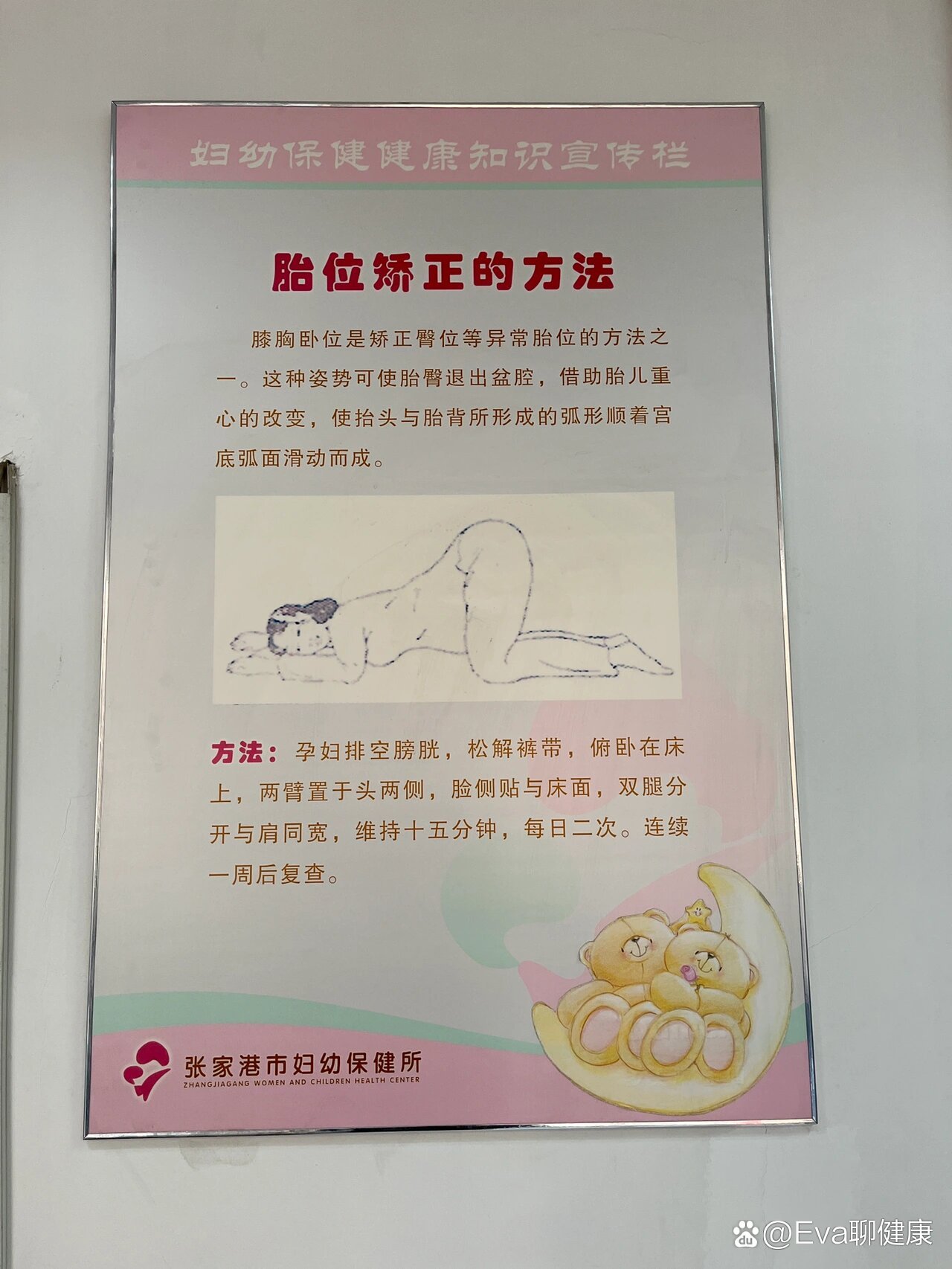 胎膜早破取什么卧位