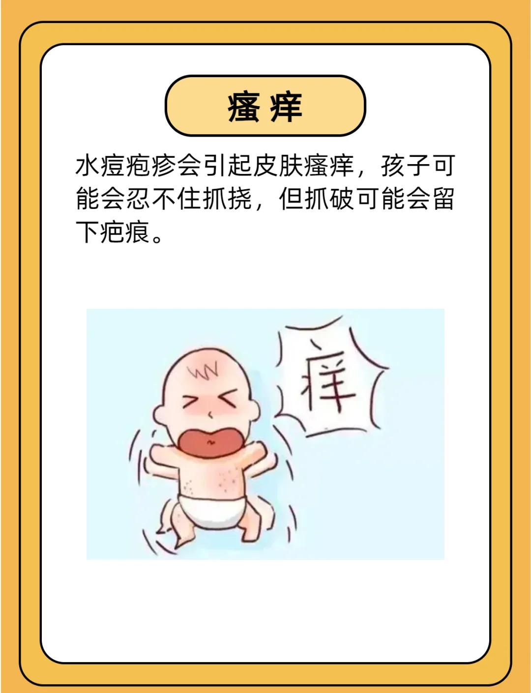 长水痘的前兆是什么