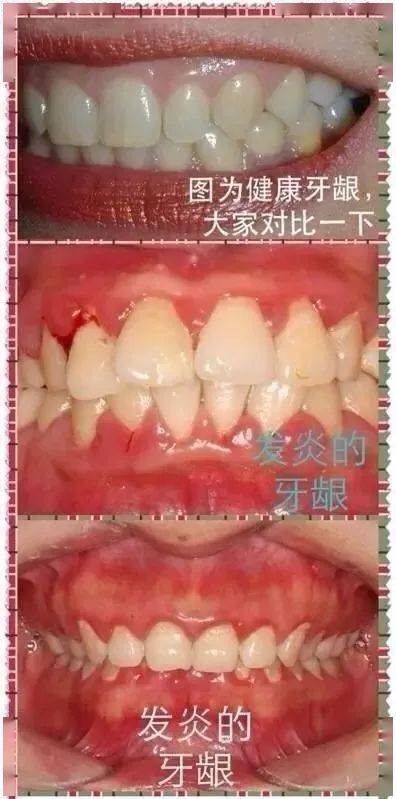 同房后有淡红色的血是怎么回事