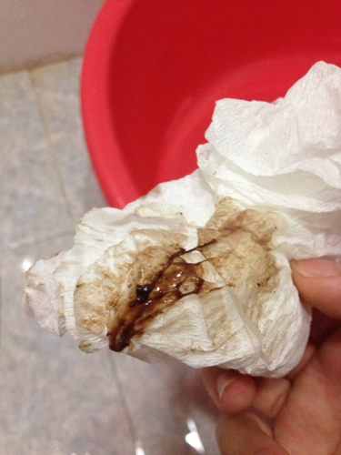 同房后有淡红色的血是怎么回事