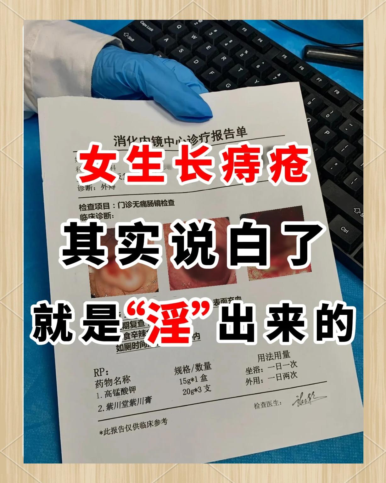 血栓外痔的肿块多久可以消失?