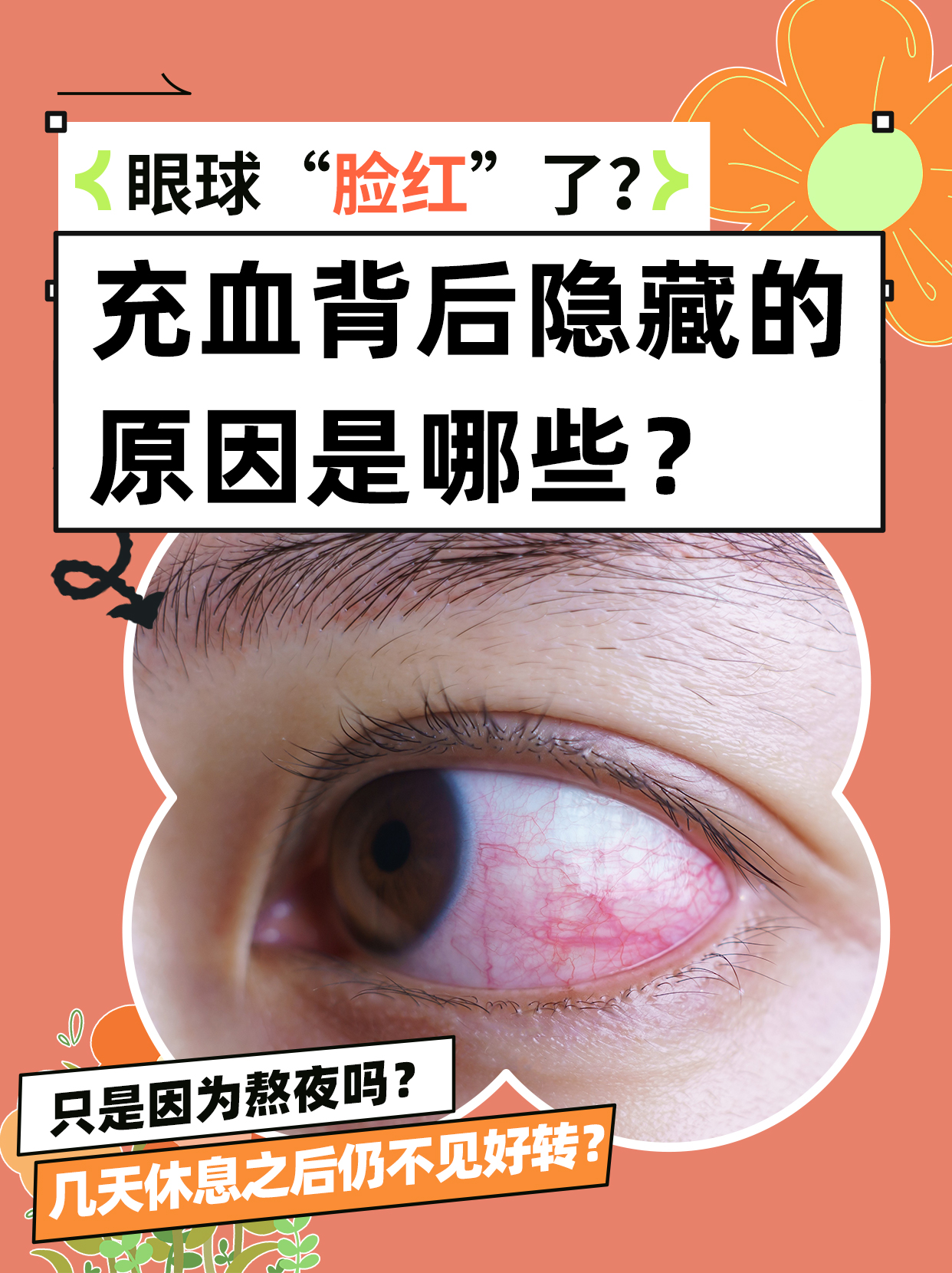 眼睛红是怎么回事