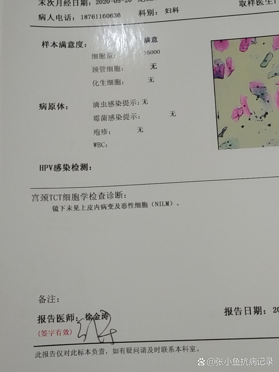 他用手指在我阴内抽动