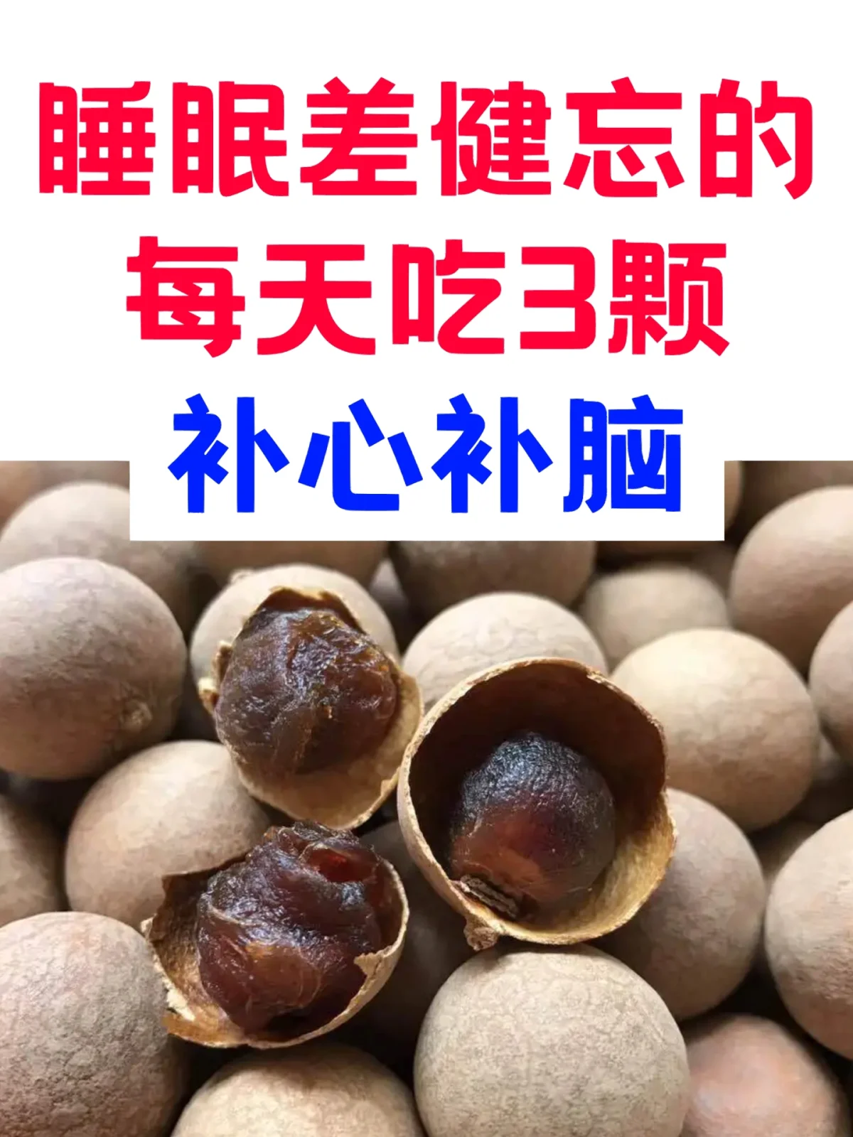 健忘怎么办健忘能改善吗