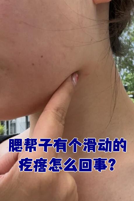 腮腺炎早期有哪些症状