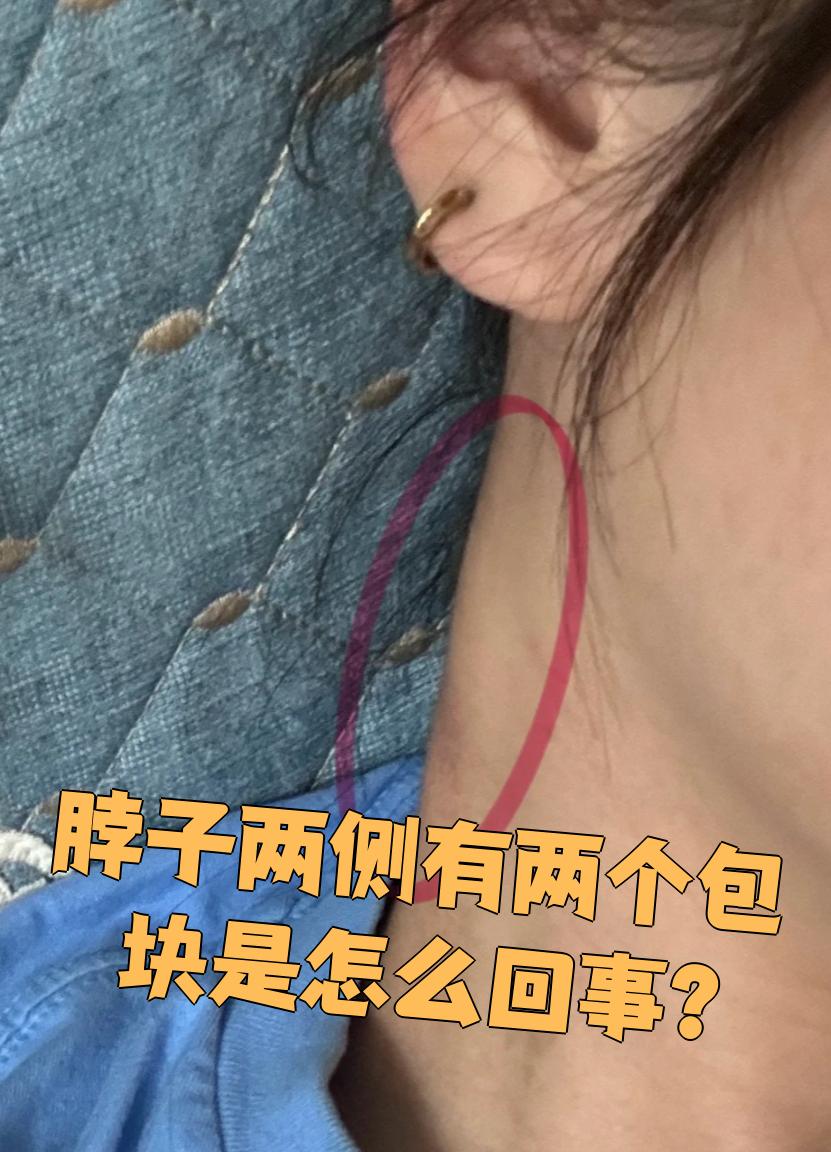 颈部淋巴癌早期症状有哪些