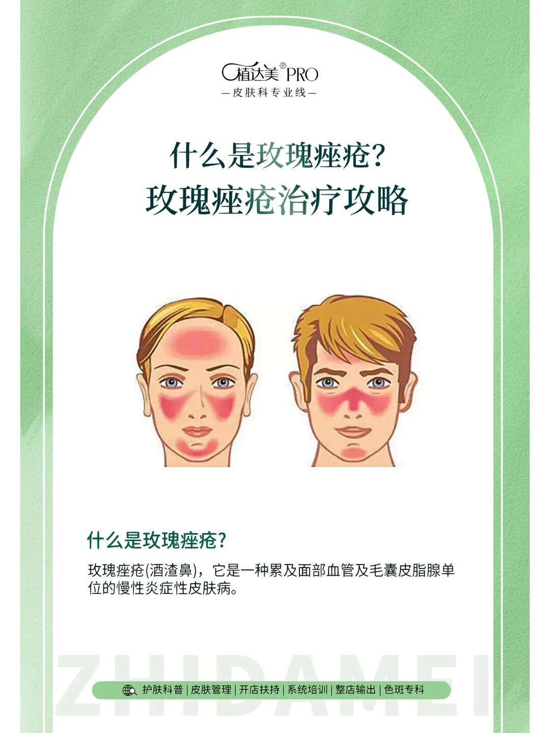 玫瑰痤疮是什么引起的