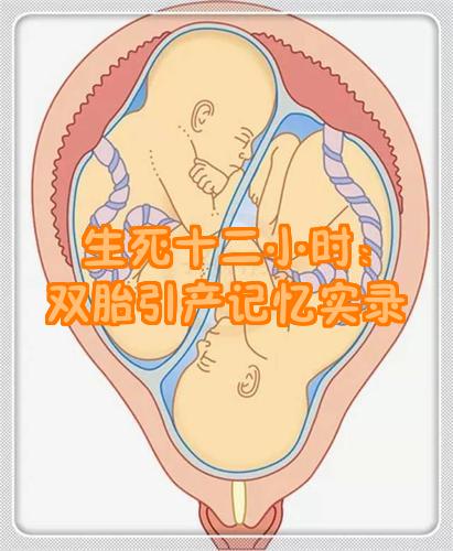 四个月能引产吗