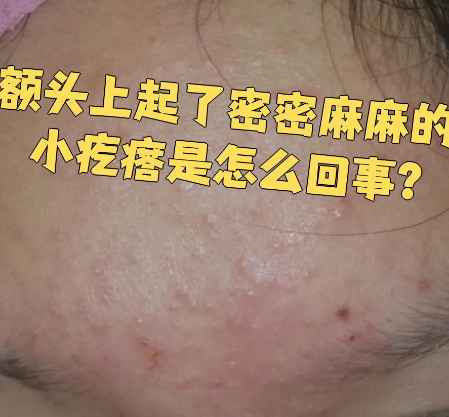 脸上起疙瘩是怎么回事