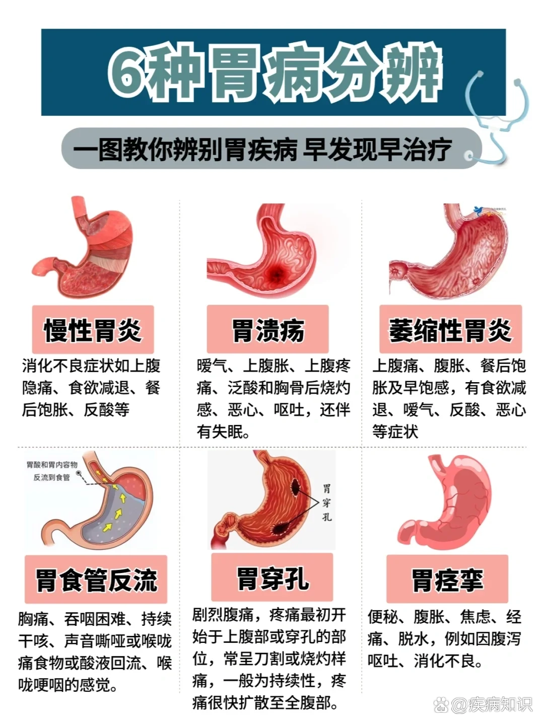 胃病的症状有什么?