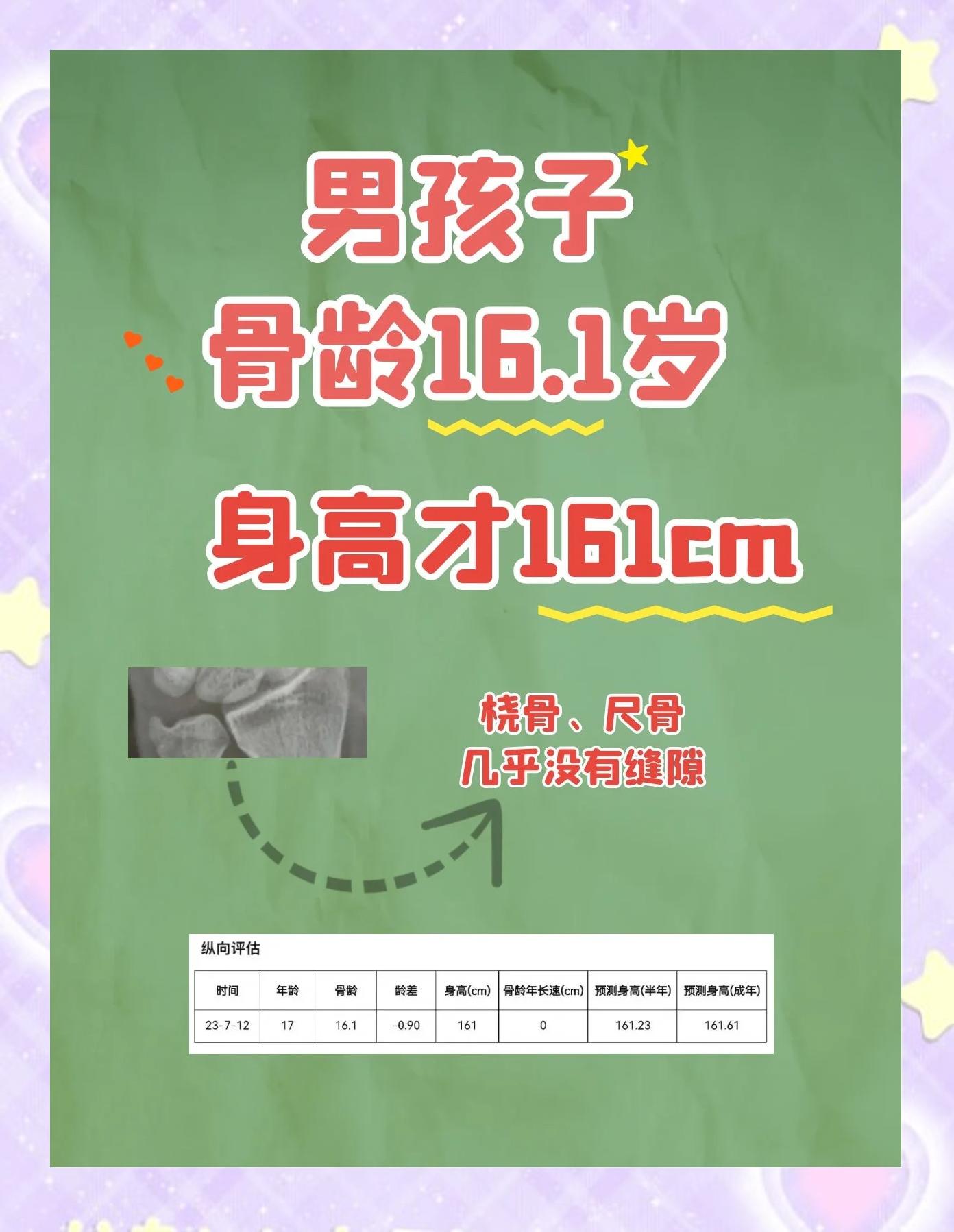 16周岁想长高怎么办