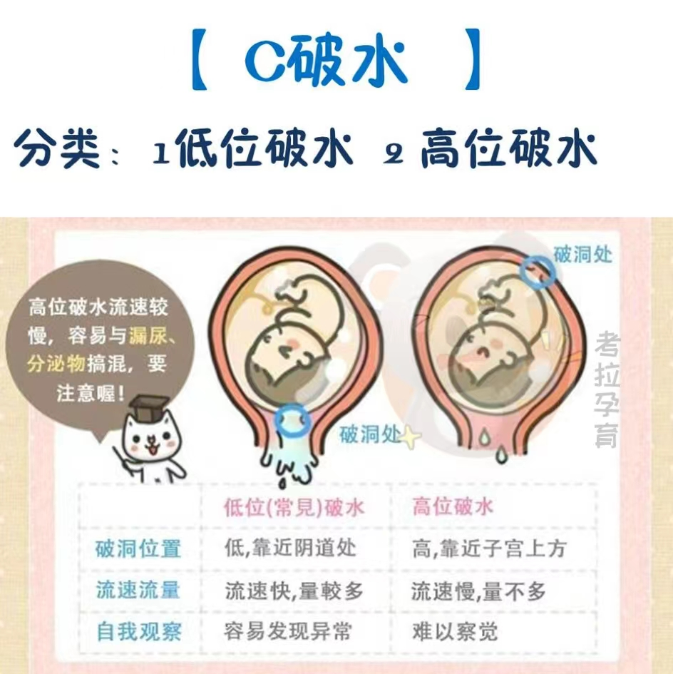 高位破水是什么症状