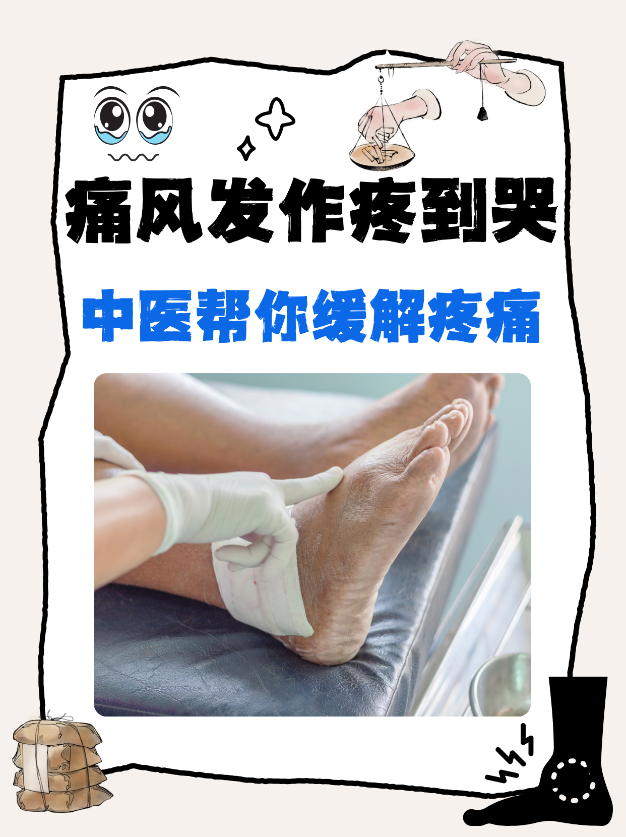 急性痛风怎么缓解