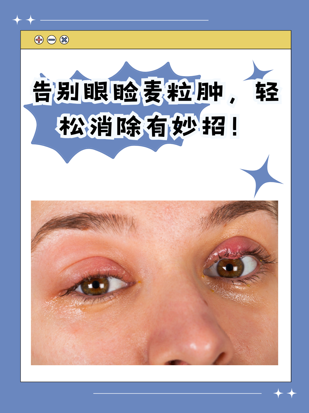 麦粒肿是怎么引起的