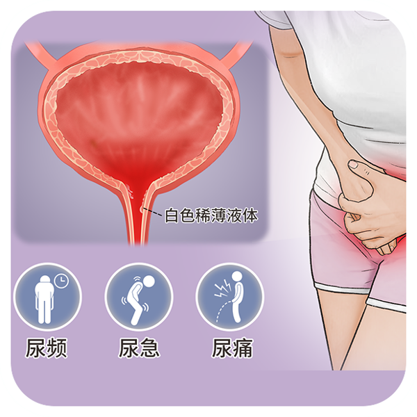 阴道炎会自愈吗