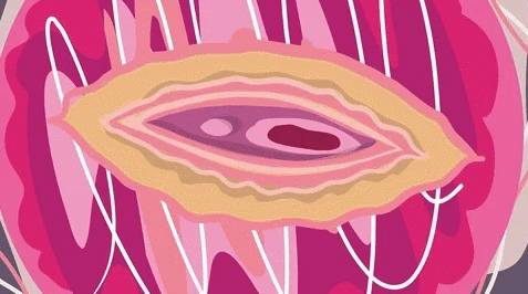 阴道炎会自愈吗