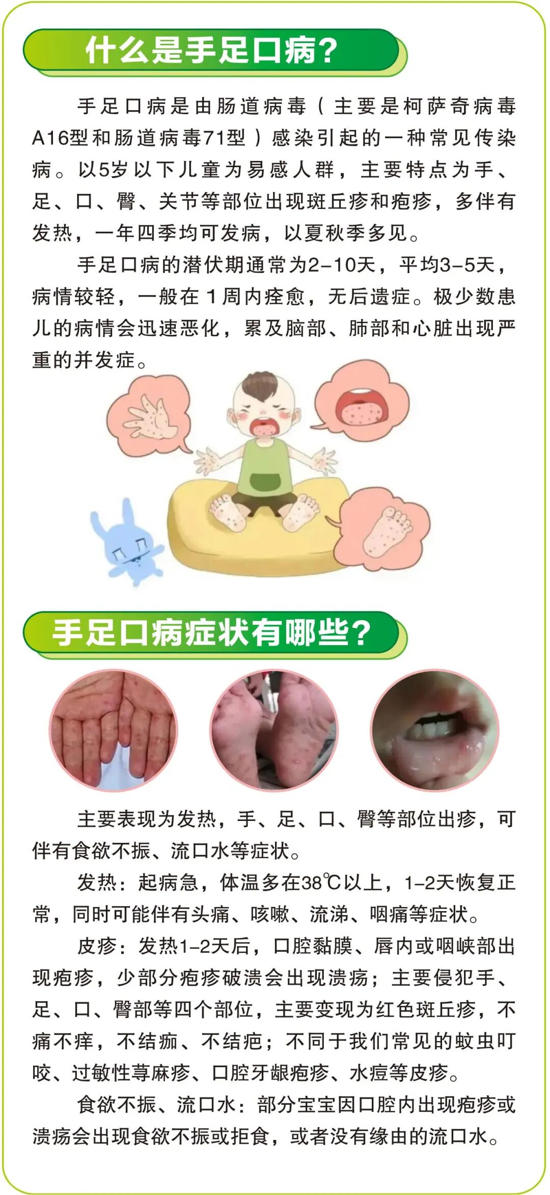 手足口病治疗办法