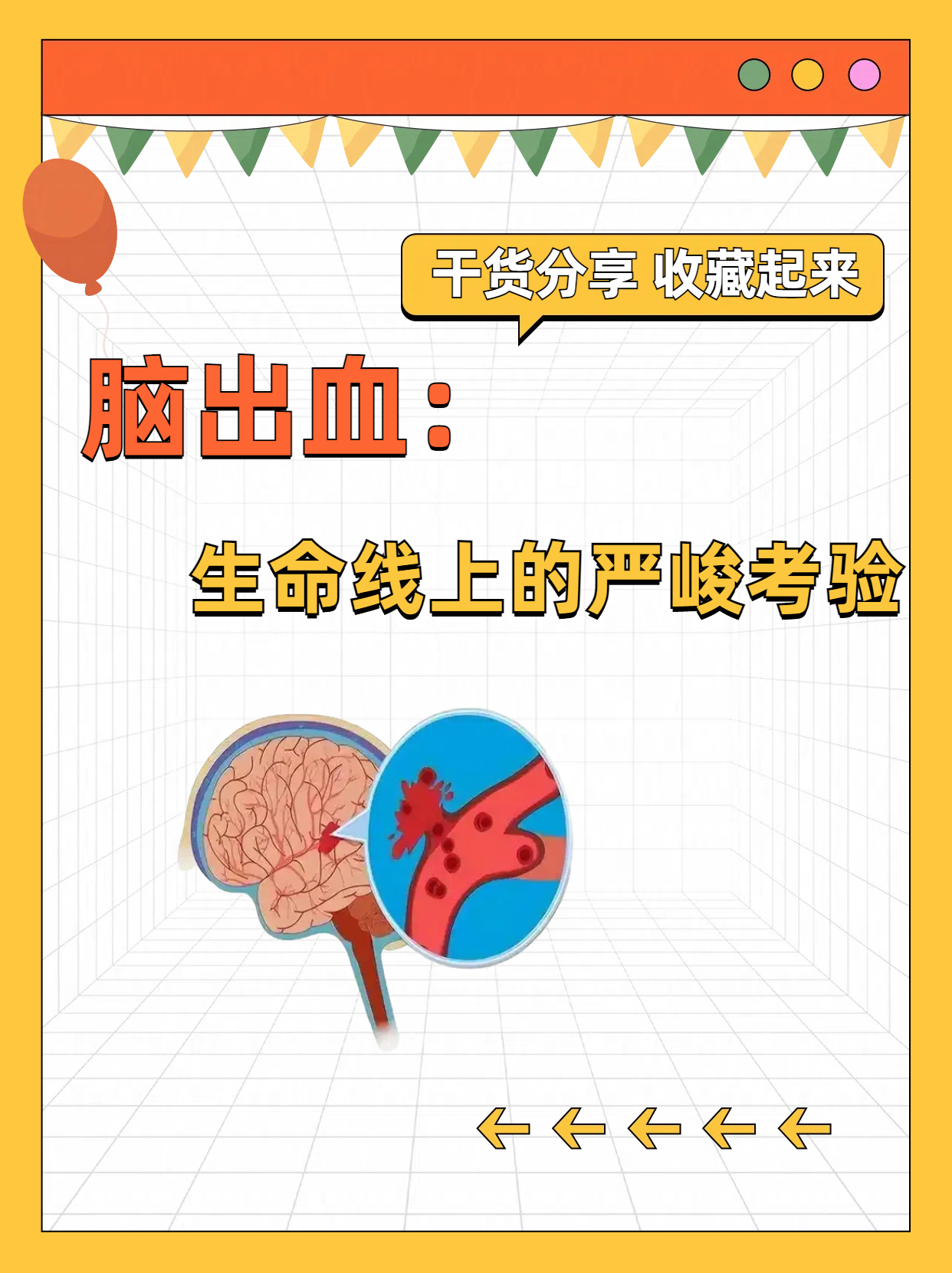 脑出血一般寿命