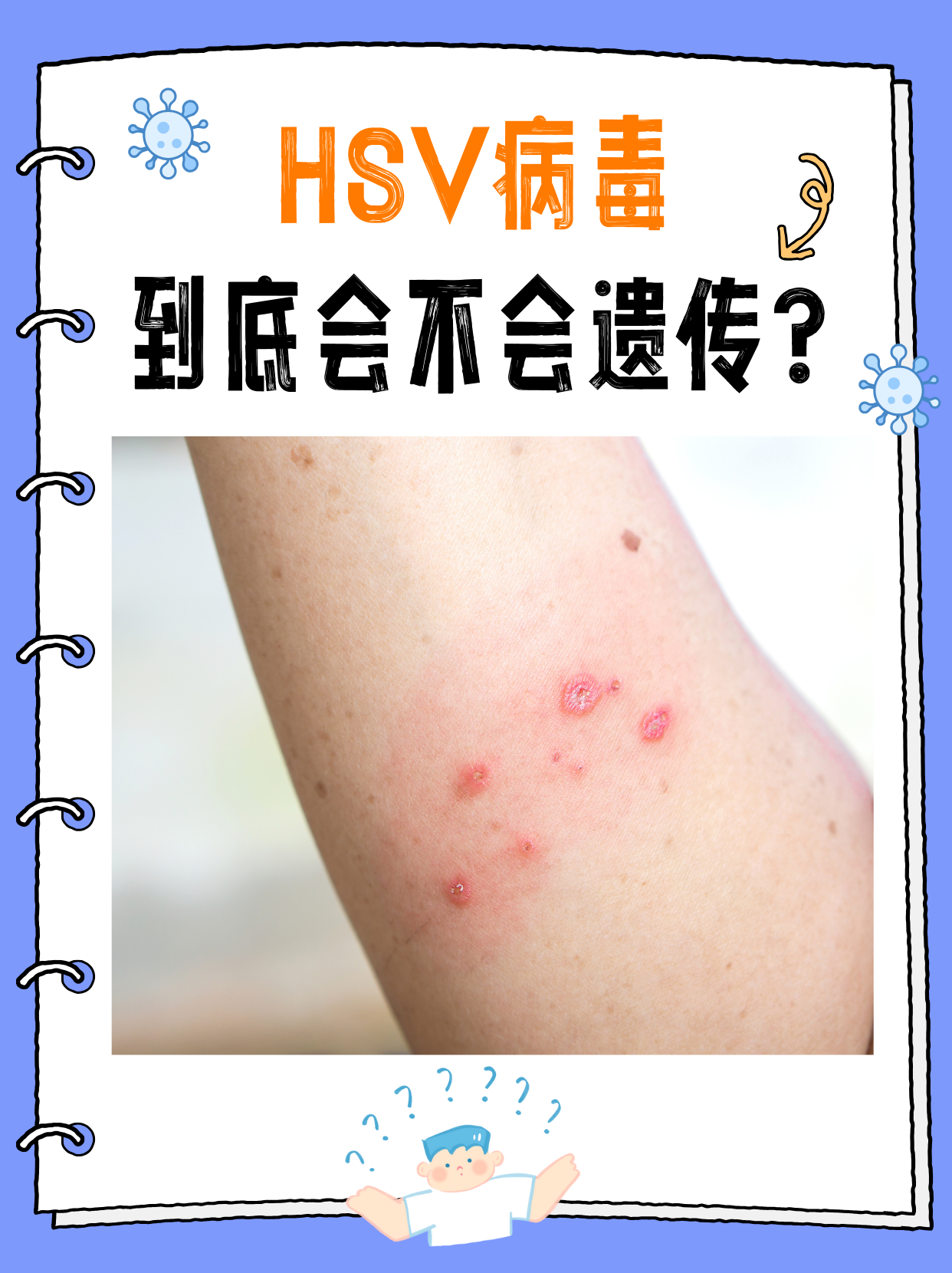 单纯疱疹病毒igg阳性?