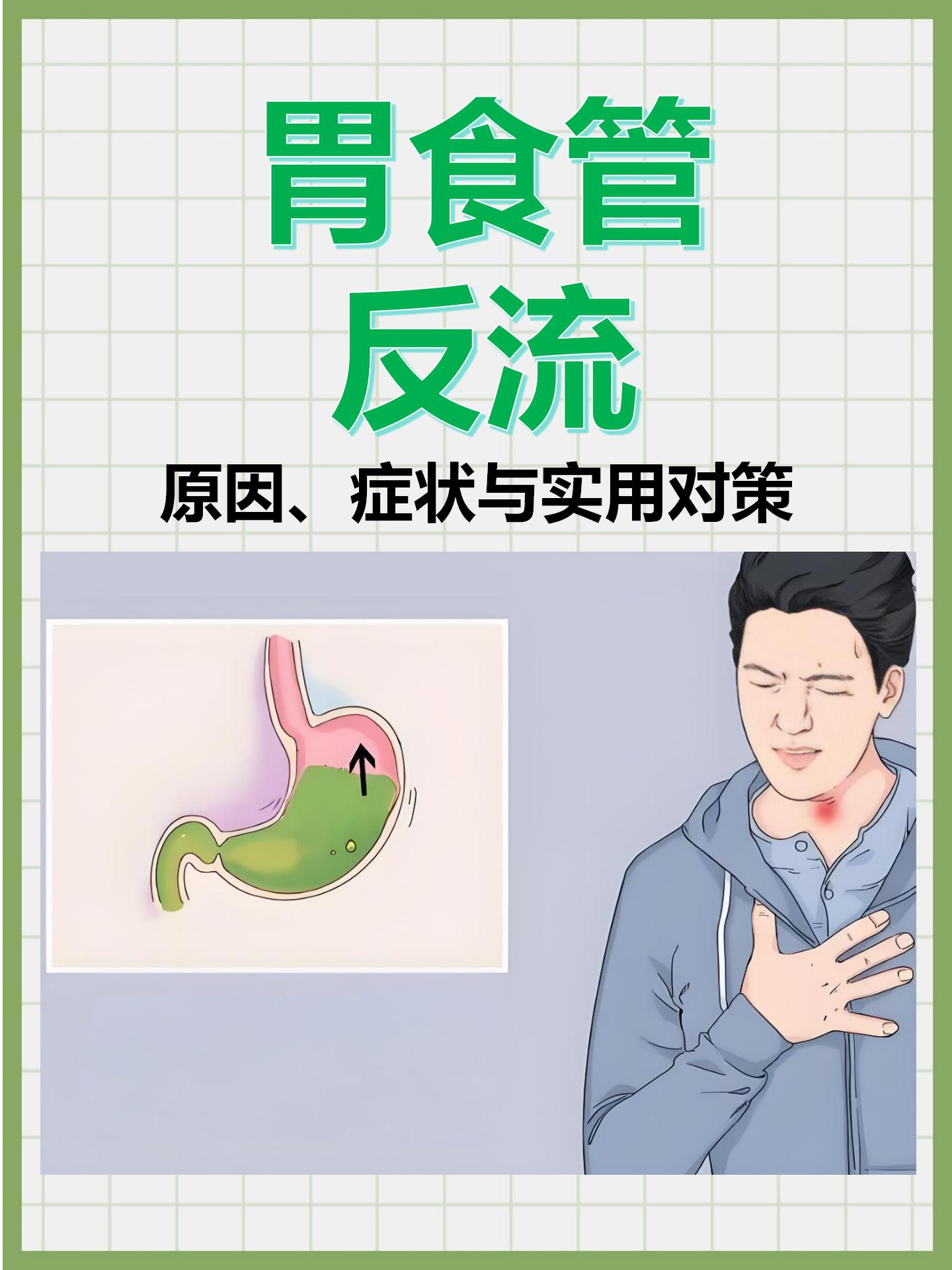 反流性胃炎什么症状?