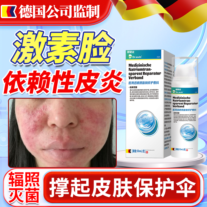 什么是激素依赖性皮炎?