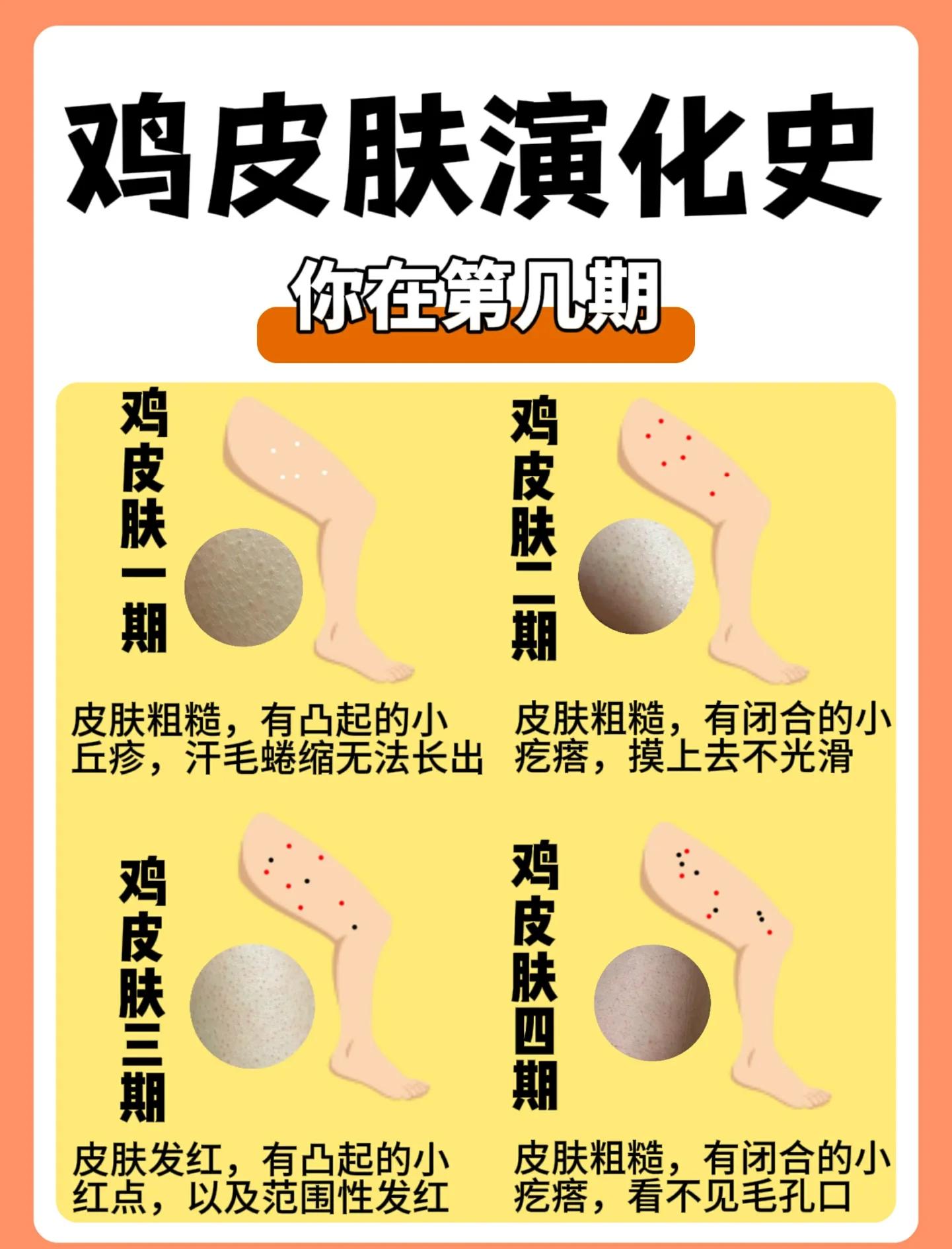 身上的鸡皮疙瘩怎么去除