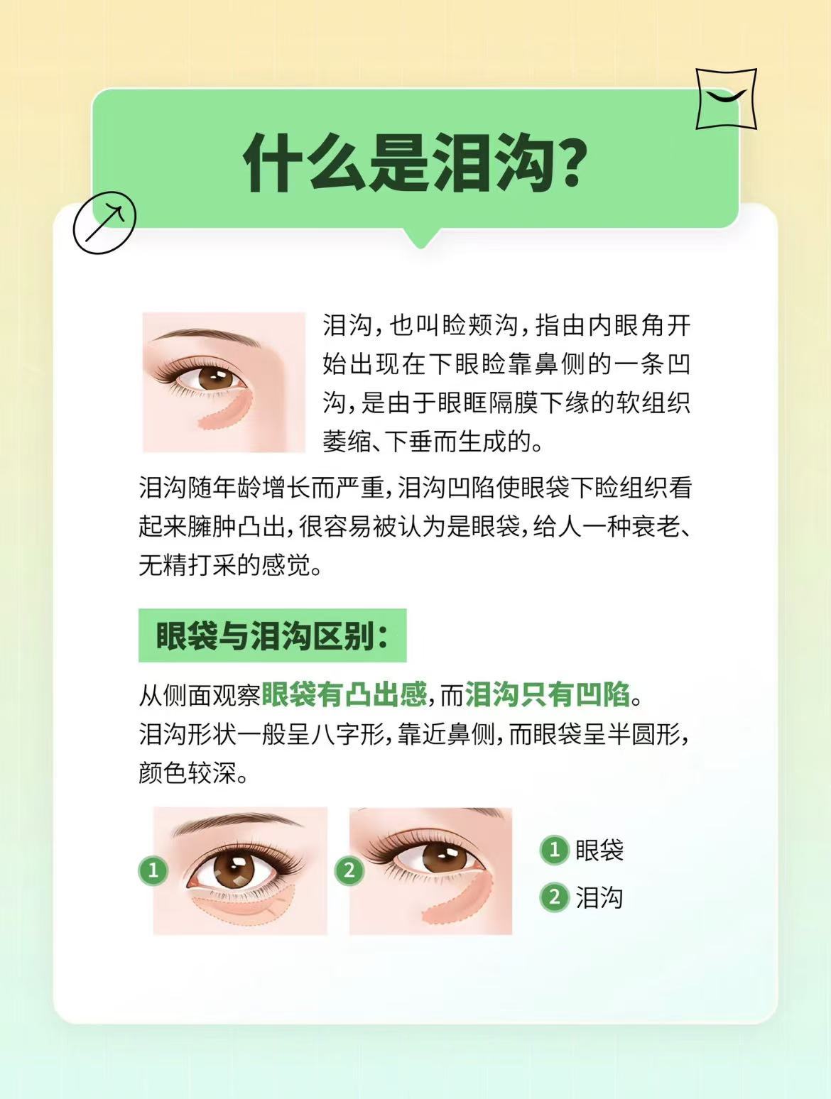 眼睛迎风流泪的原因