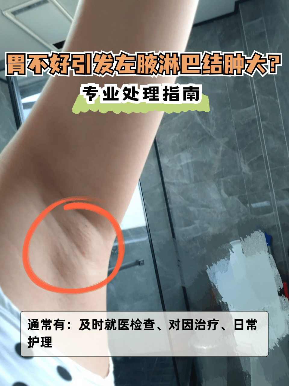 淋巴结怎样治疗