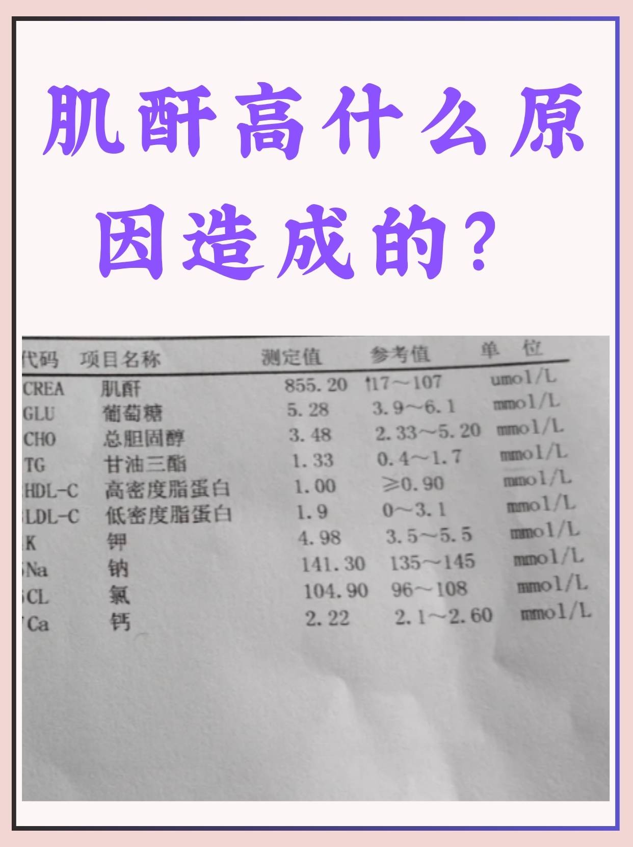 人的正常肌酐指标是多少