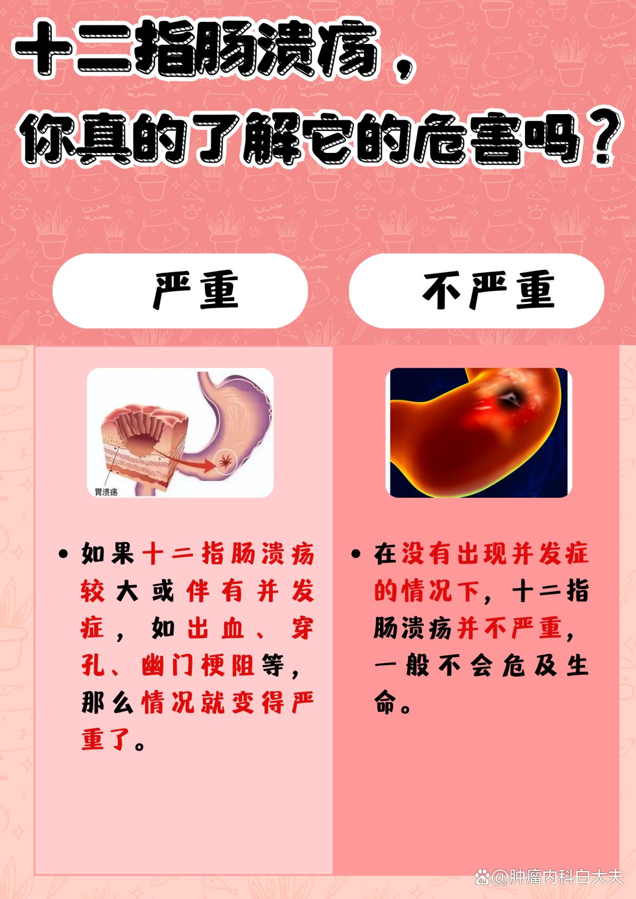 12指肠溃疡怎么治疗