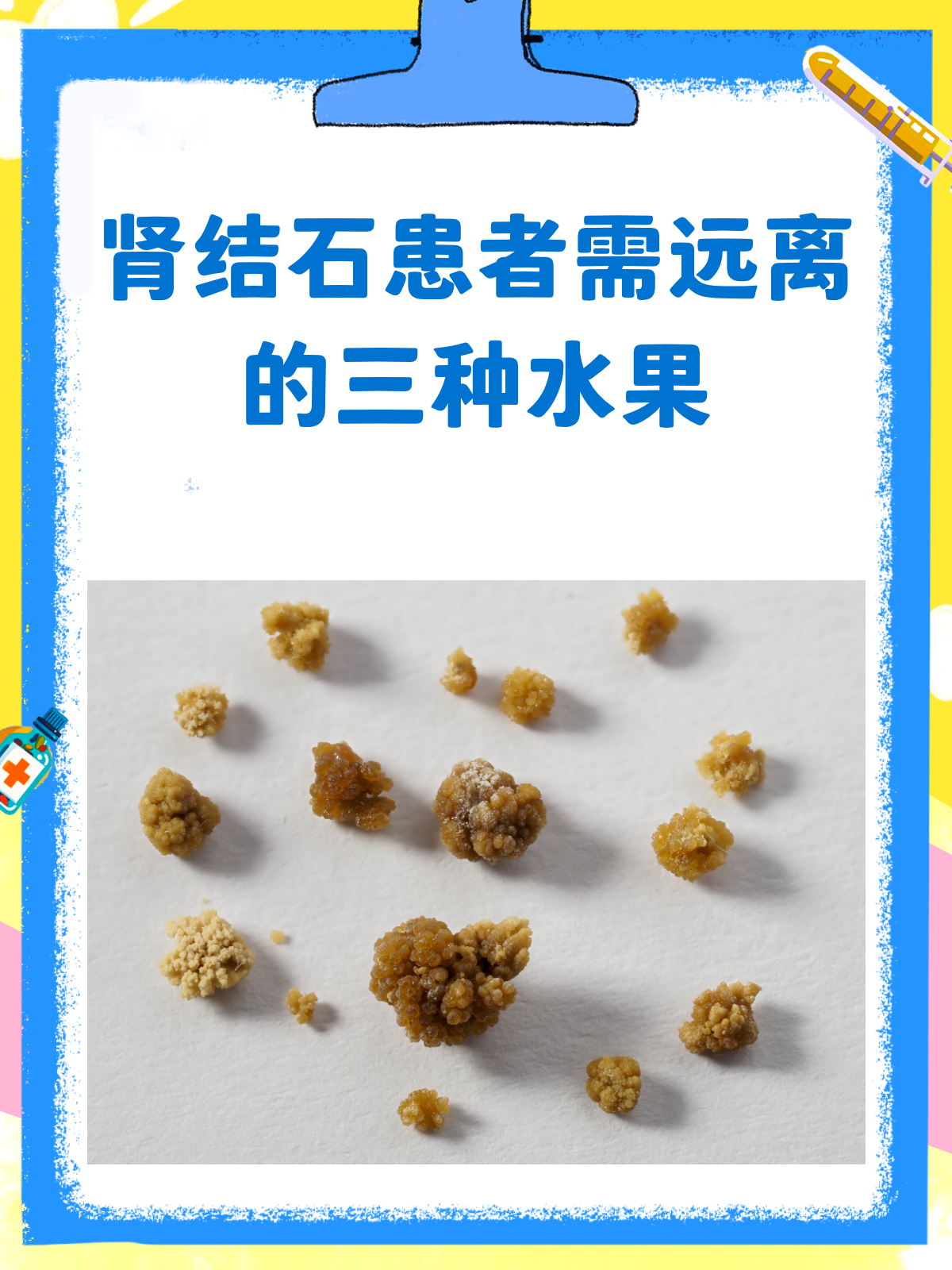 胆结石可以吃什么水果好